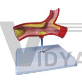 The model of thrombus